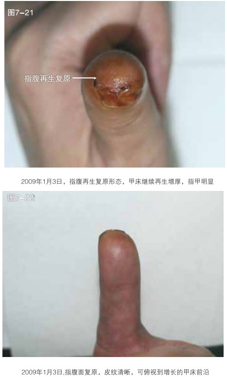 201121815824896