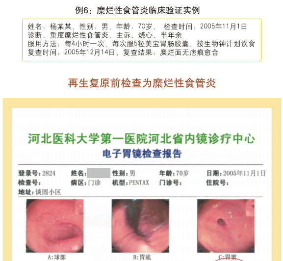201122014418101