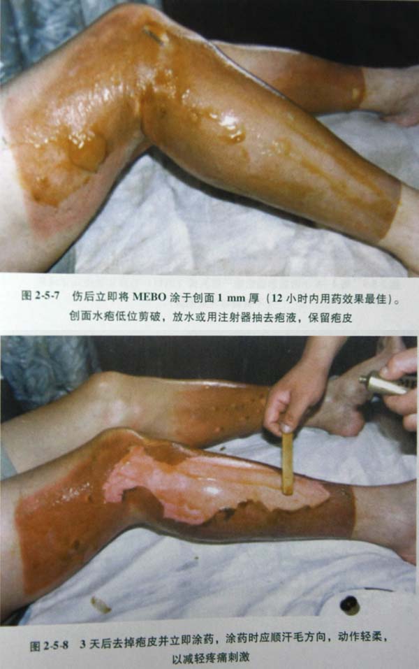 201131142410281