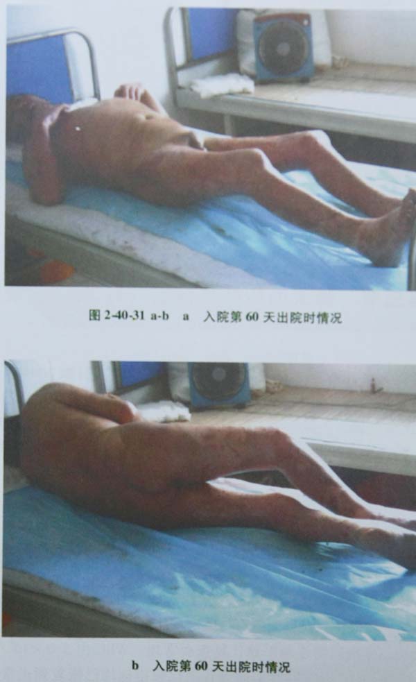 20113410396437